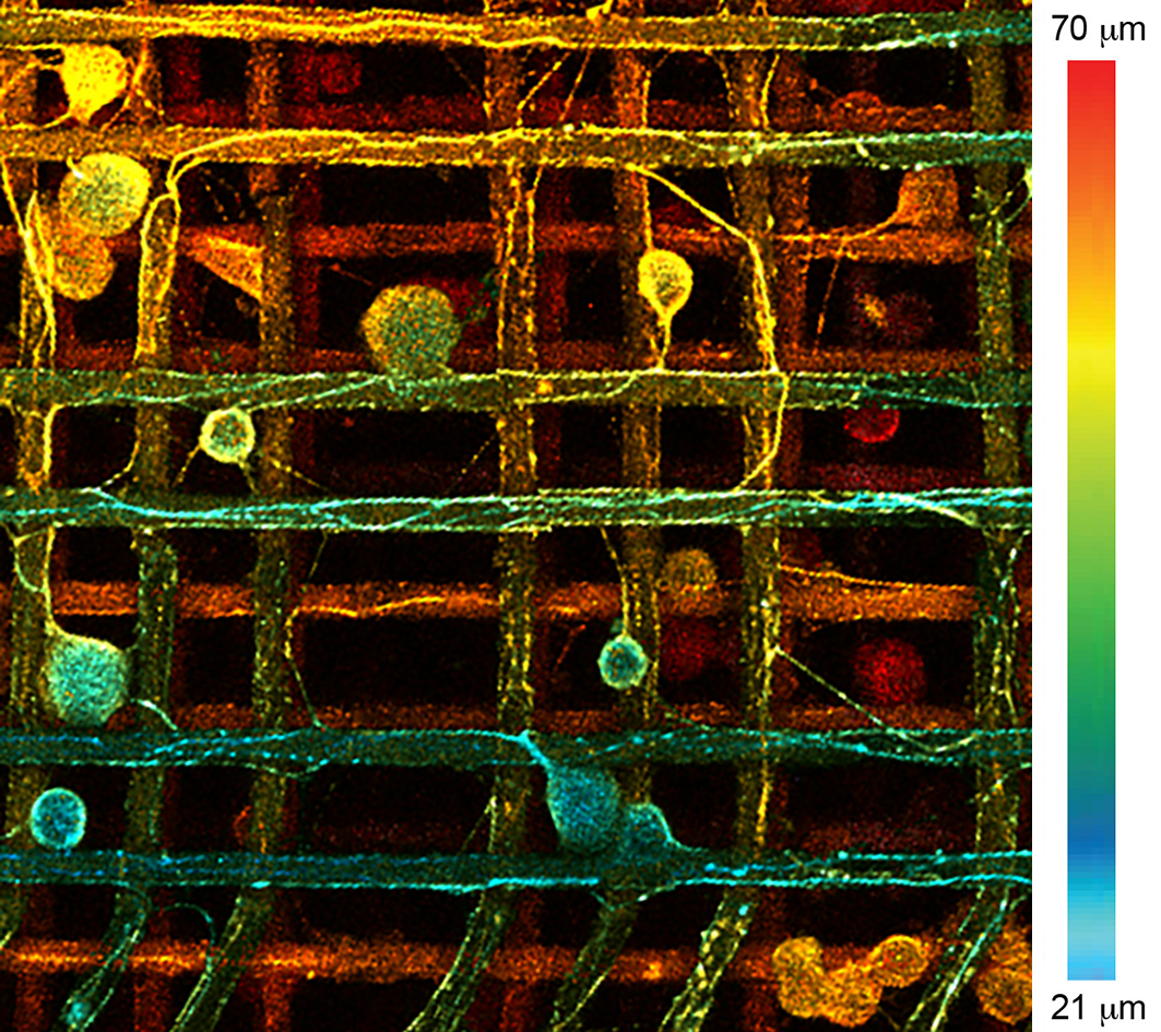 Нейрони вросли в багатошаровий каркасний матеріал. Клітини забарвлені відповідно їхньої глибини занурення в каркас.&amp;nbsp;&amp;nbsp;Lokesh Agrawal et al. / Materials Science and Engineering: C, 2021