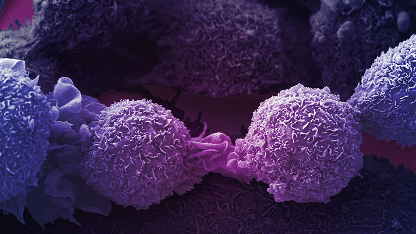 Клітини раку легень. Anne Weston / Francis Crick Institute