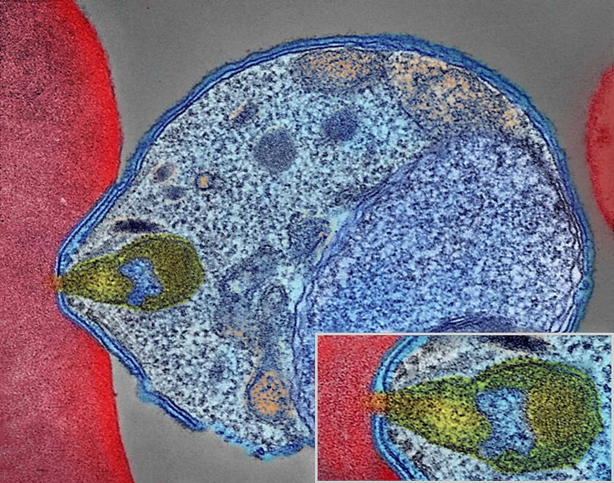 Малярійний паразит, що з’єднується з людськими еритроцитами. NIAID / Wikimedia Commons