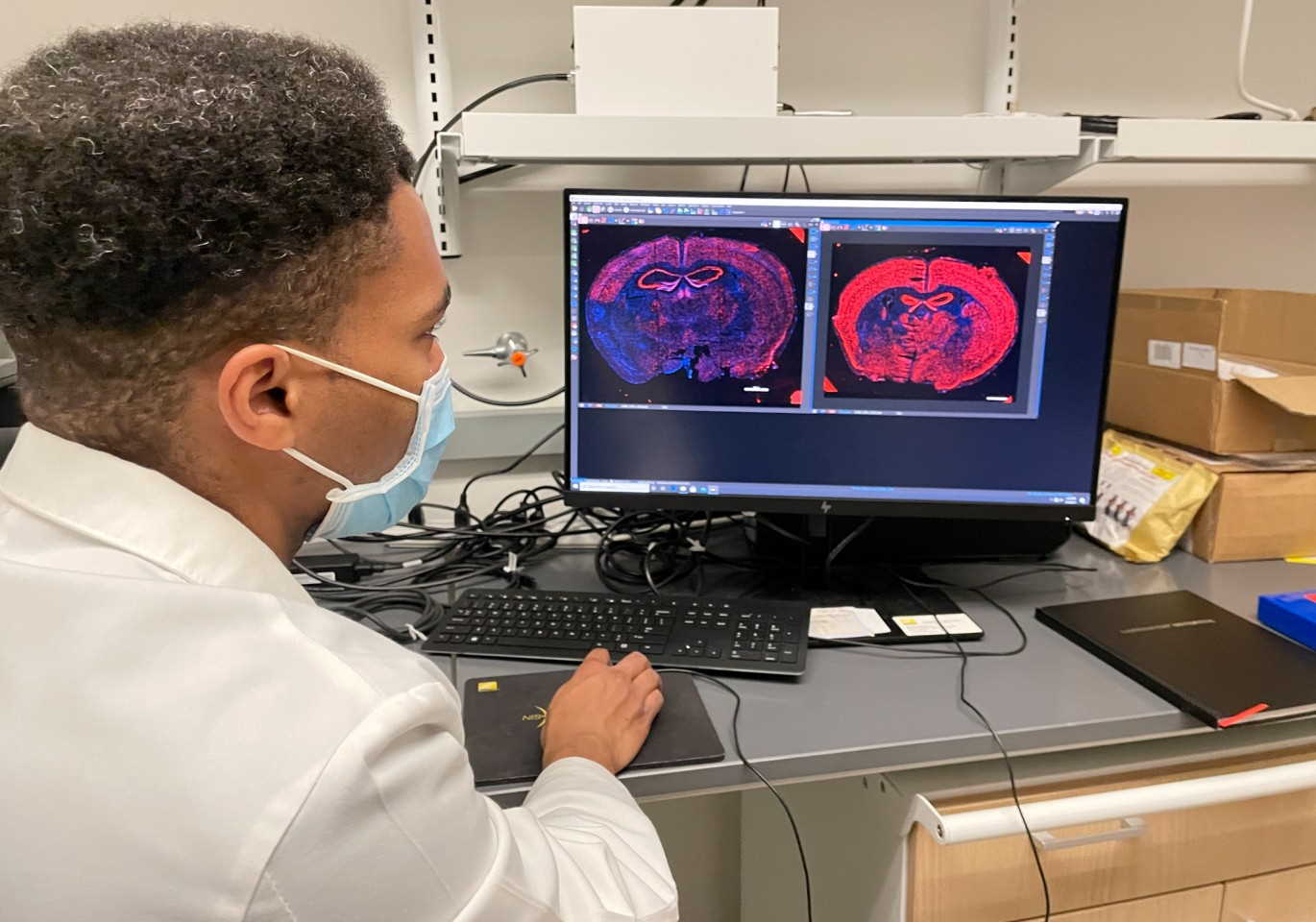 Один з авторів статті, Джордан Мур (Jordan Moore), переглядає МРТ-скани мишачого мозку. Ohio State University Wexner Medical Center