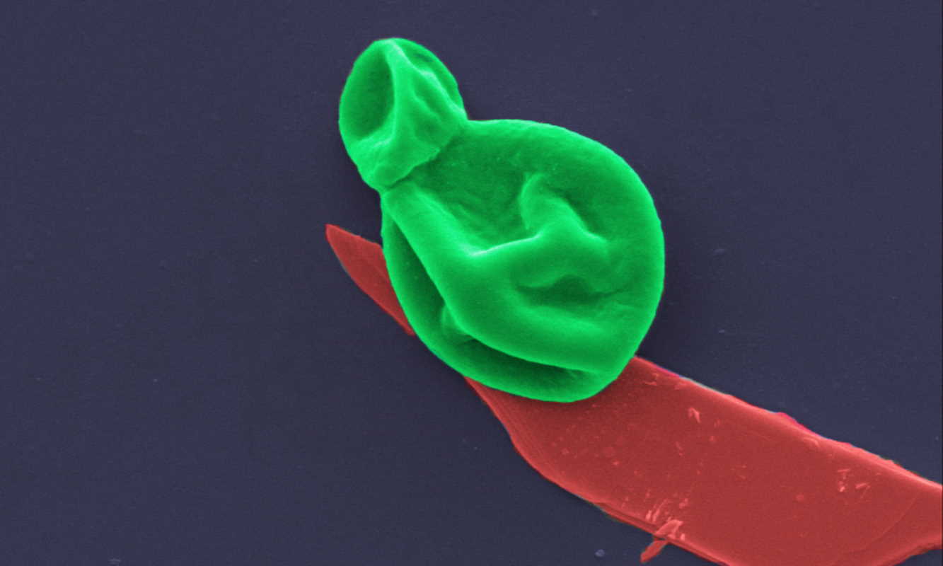 Клітина гриба (зелена) на надтонкому фрагменті надтонкого шару чорного фосфору (червоний). RMIT University