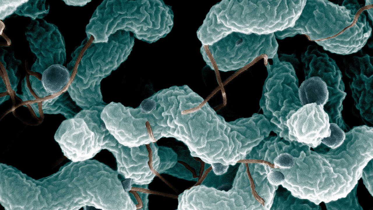 Мікроскопічне зображення бактерій Campylobacter. De Wood / Wikimedia Commons