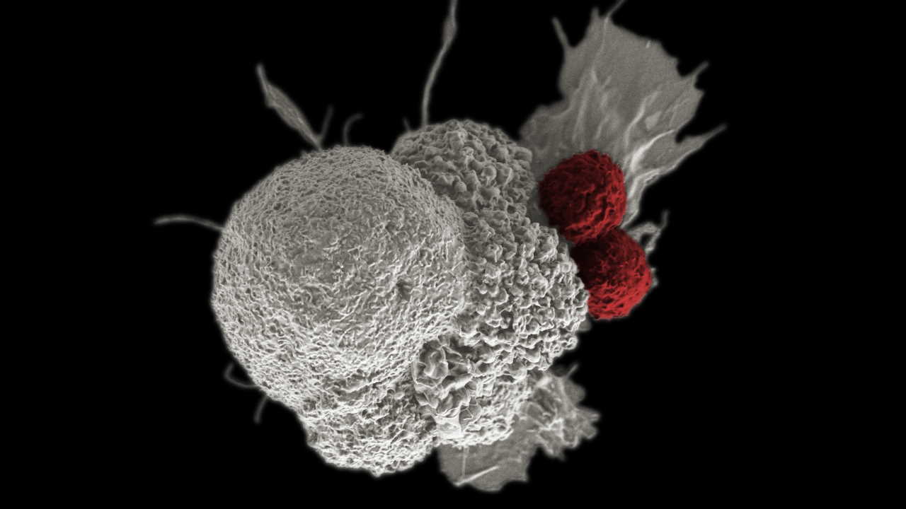 Т-клітини (червоні) атакують ракову клітину (біла). National Cancer Institute