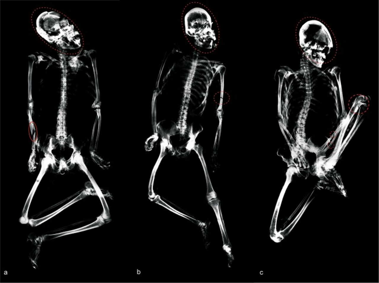 Рештки трьох осіб зі смертельними пораненнями черепа, знайдені у спільному похованні. Standen et al. / Journal of Anthropological Archaeology, 2021