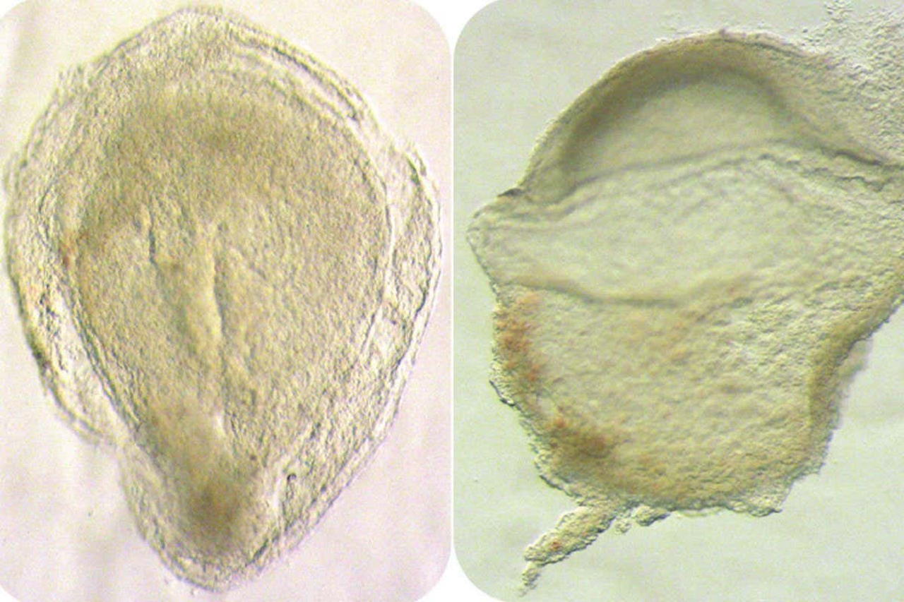 Вигляд людського ембріона на стадії гаструляції зверху (зліва) та збоку (справа).Tyser et al. / Nature, 2021