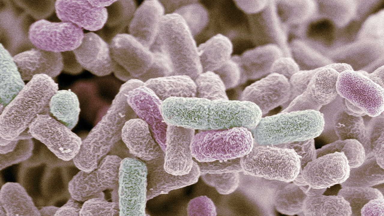 E. coli. STEVE GSCHMEISSNER — Getty Images / Science Photo Library RM