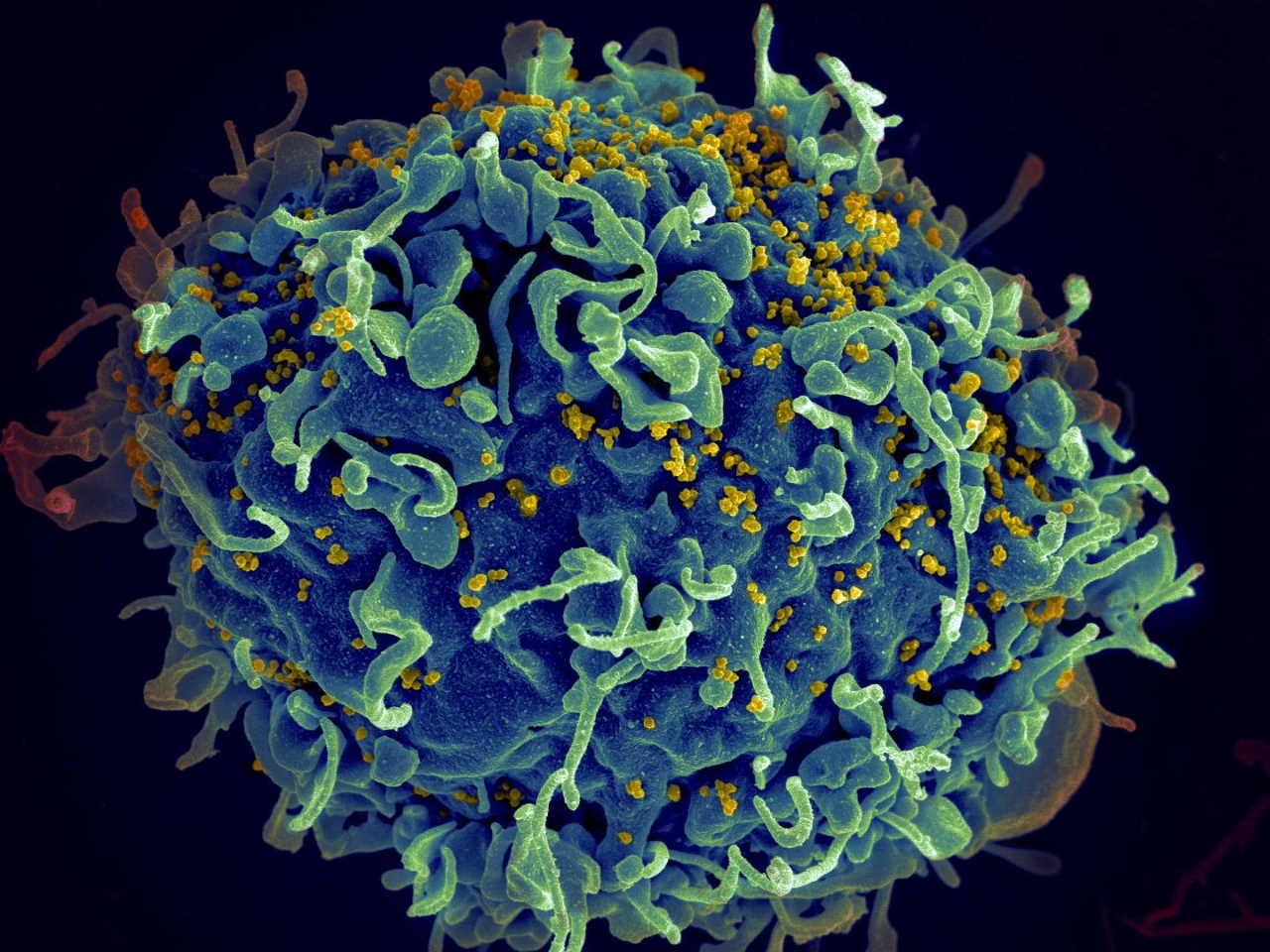 Імунна Т-клітина людини (синя) атакується вірусами імунодефіциту людини (жовті). Seth Pincus, Elizabeth Fischer and Austin Athman / National Institute of Allergy and Infectious Diseases