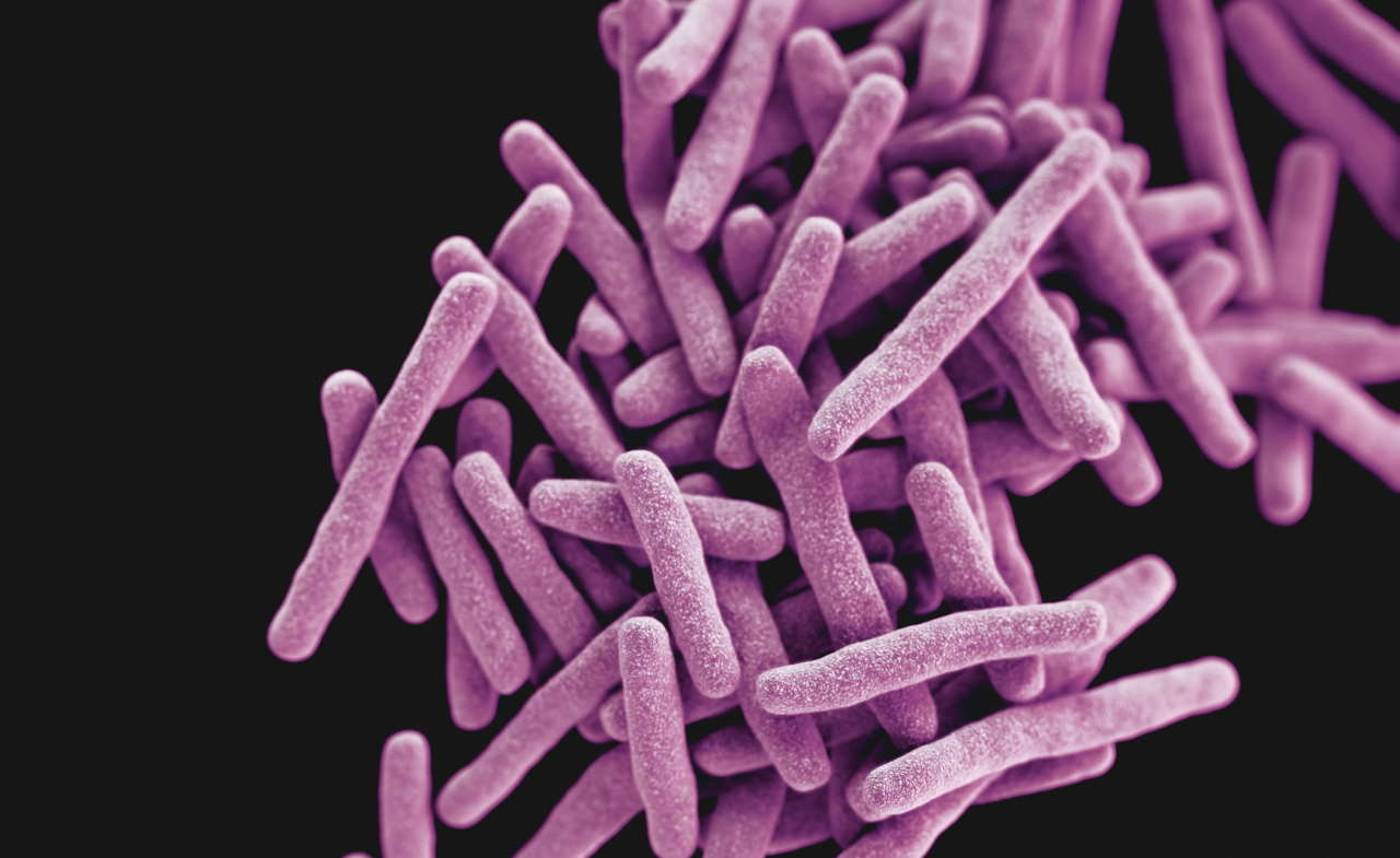 3D-зображення стійких до антибіотиків збудників туберкульозу Mycobacterium tuberculosis. CDC / Unsplash