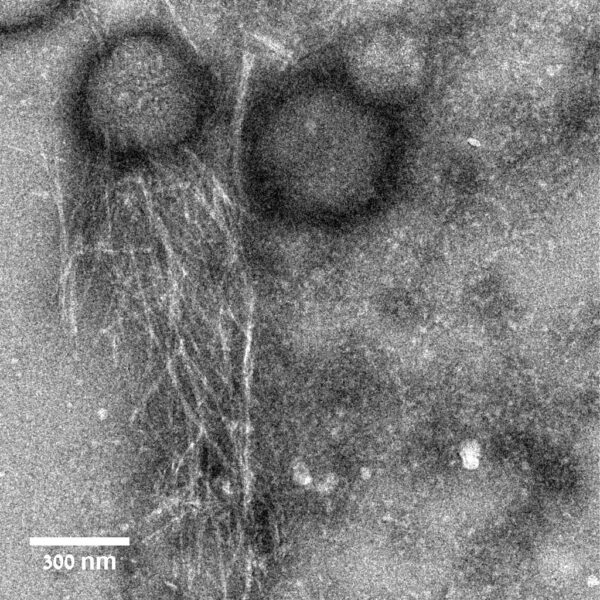 Фібрили уперину 3.5 оточують бактерії M. luteus. Nir Salinas / Technion