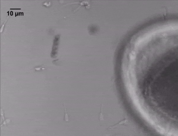 Мікромотор допомагає сперматозоїду запліднити яйцеклітину. Mariana Medina-Sánchez et al / Nano Letters, 2016