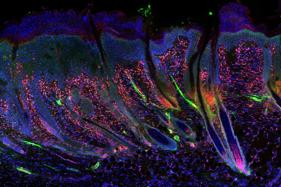 Мікроскопічне зображення регенерованої шкіри із волосяними фолікулами. Washington State University
