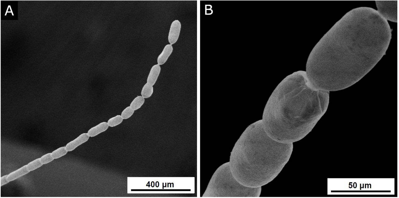 Бактерія&amp;nbsp;Thiomargarita magnifica. Volland et al. / bioRxiv, 2022