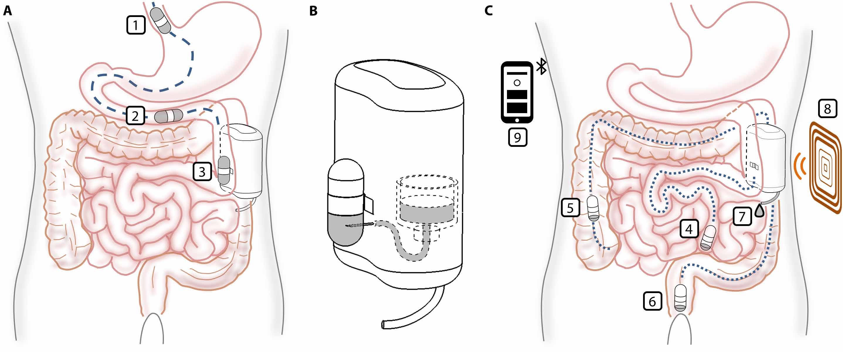 Схематичне зображення процесу сполучення магнітної капсули з імплантатом для його наповнення (зліва), а також зарядження пристрою та вивення капсули з організму (справа).&amp;nbsp;Veronica Iacovacci et al. / Science Robotics, 2021