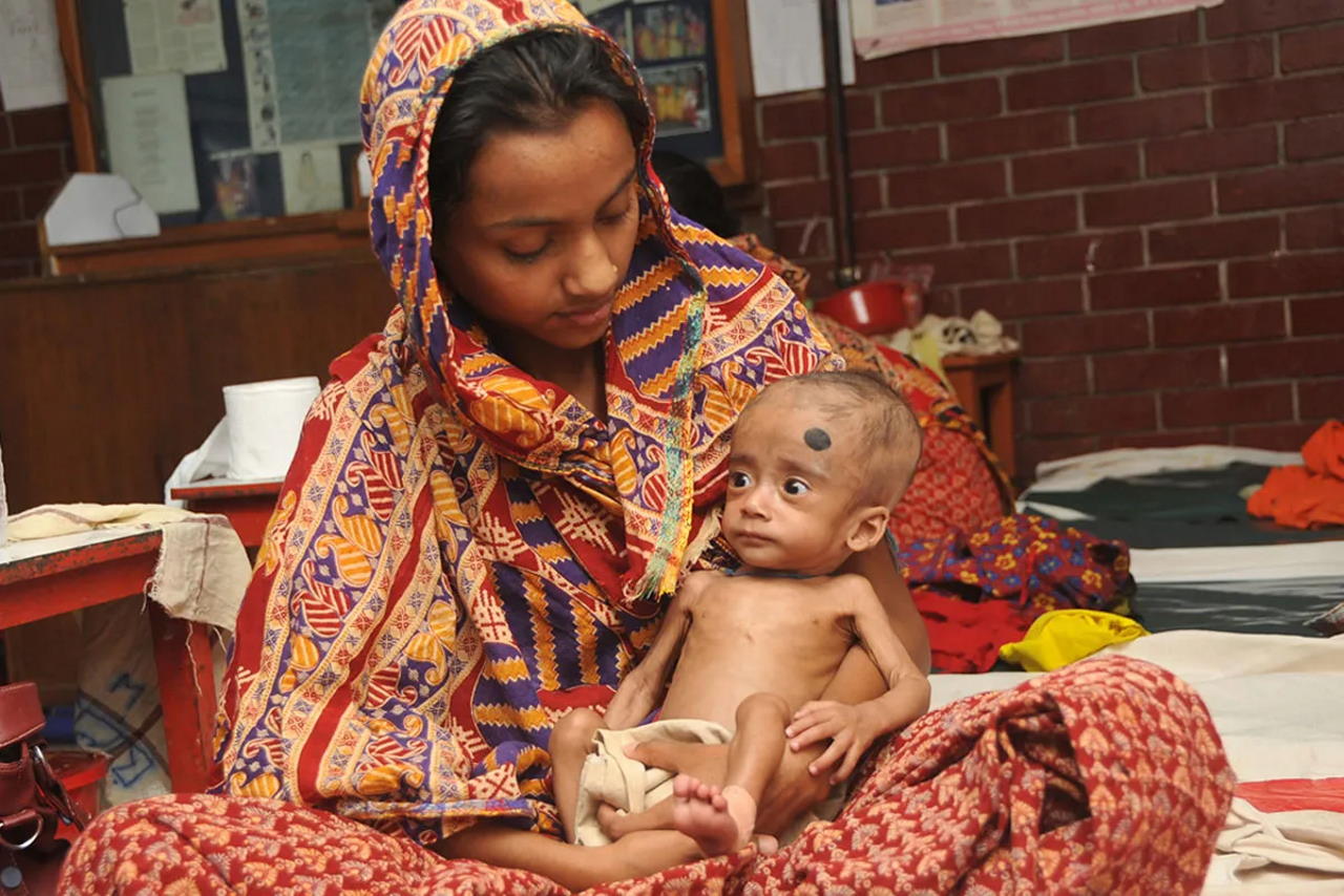 Мати та її дитя з недостатнім харчуванням, Бангладеш.&amp;nbsp;International Centre for Diarrhoeal Disease Research, Bangladesh