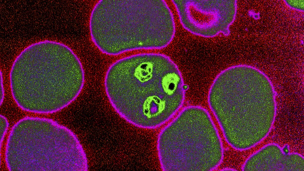 Малярійні плазмодії (зелені) в інфікованій клітині. James Cavallini / BSIP SA
