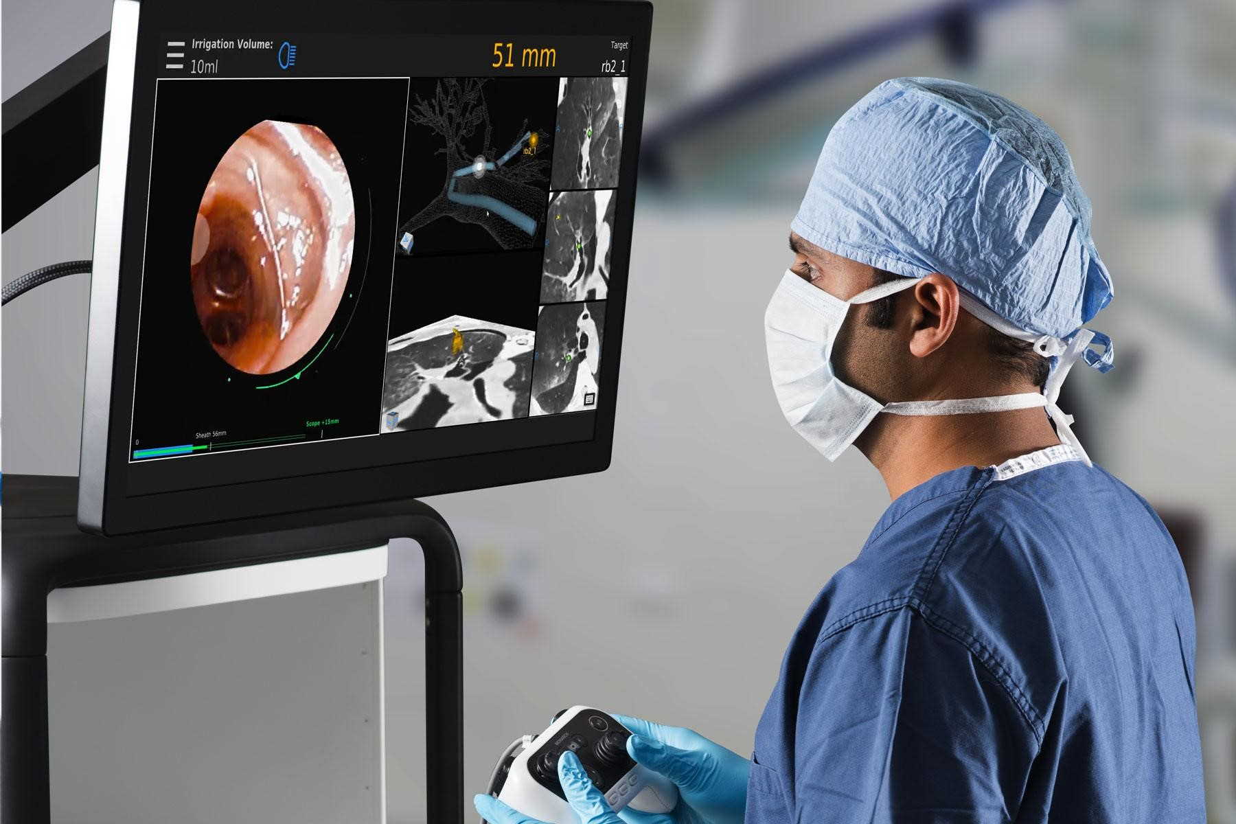 Лікар проводить бронхоскопію за допомогою Monarch Platform / Auris Health