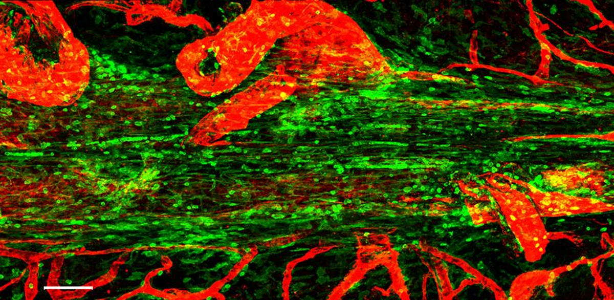 Імунні клітини (зелені) біля кровоносних судин (червоні). Zach Fitzpatrick / University of Cambridge