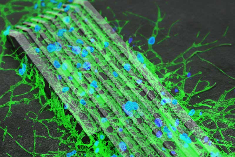 Мікробот, вкритий зеленими та блакитними нейронами.&amp;nbsp;Hongsoo Choi /&amp;nbsp;DGIST