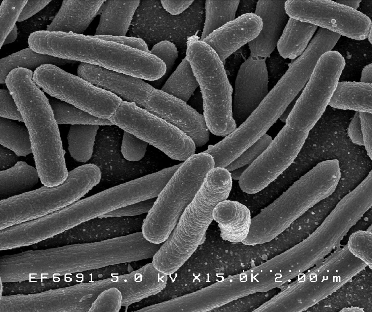 Кишкова паличка (Escherichia coli) під мікроскопом. NIAID