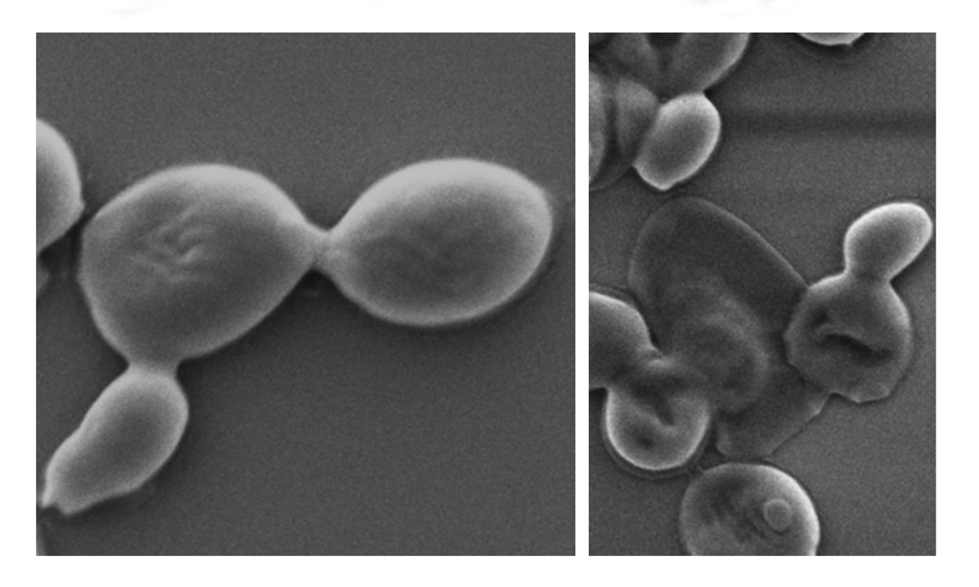 Гриб&amp;nbsp;Candida auris&amp;nbsp;до (зліва) та після (справа) впливу наношарів чорного фосфору. RMIT University