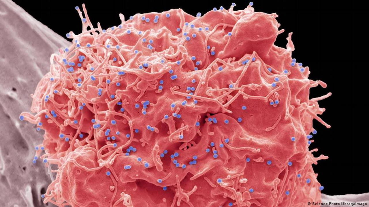 ВІЛ-інфікована клітина. Science Photo Library