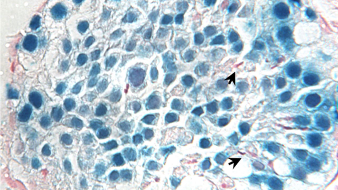Зріз сім'яного канальця миші після трансплантації пацючих стовбурових клітин. Стрілки вказують на сперматиди.&amp;nbsp;Whelan et al. / PLOS Biology, 2022