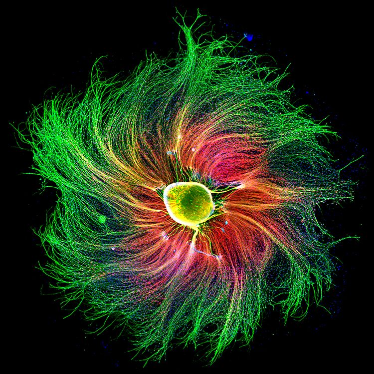 Чутливий вузол спинномозкового нерва ембріона пацюка на зображенні, створеному завдяки флуоресцентній мікроскопії.&amp;nbsp;Paula Diaz / Nikon Small World&amp;nbsp;