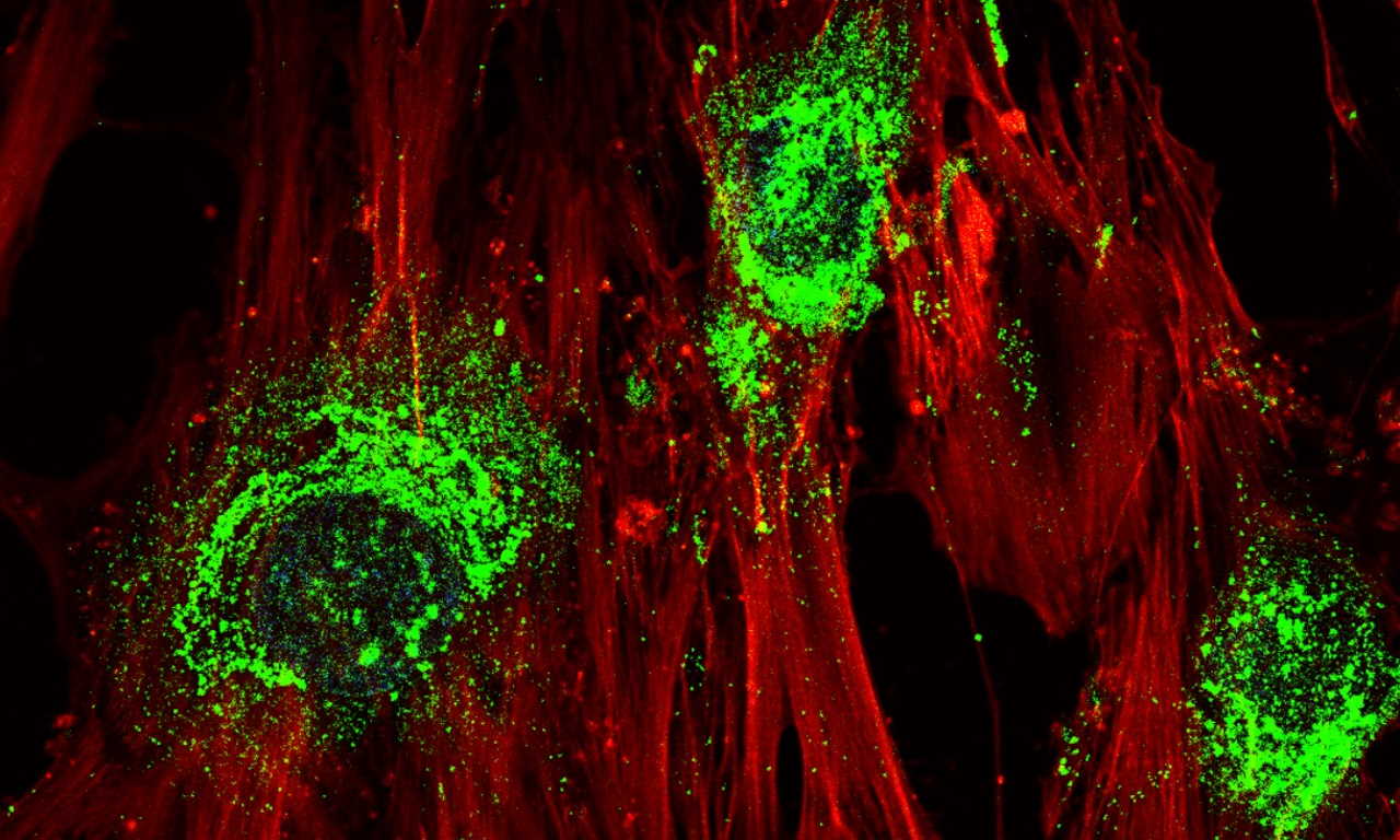 Стовбурові клітини під час перетворення на клітини кісткової тканини. Червоним позначено актинові філаменти цитоскелету, зеленим - колаген.&amp;nbsp;RMIT