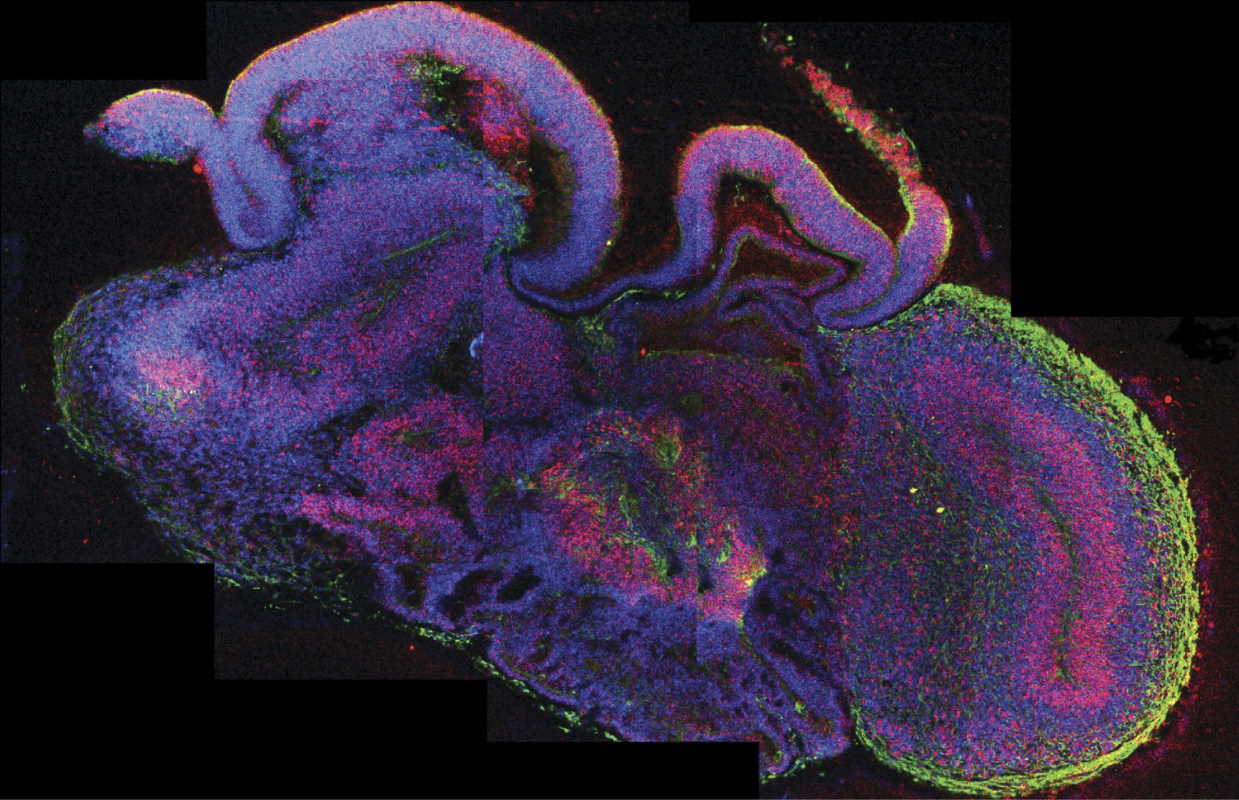 Поперечний розріз мозкового органоїда. Madeline Lancaster / EuroStemCell