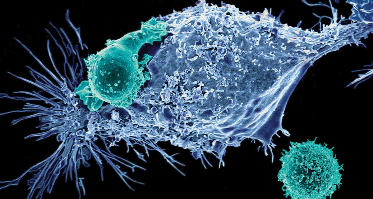 Т-клітини (зелені) атакують клітини раку (сині). Prasad Adusumilli / Memorial Sloan Kettering Cancer Center, 2017
