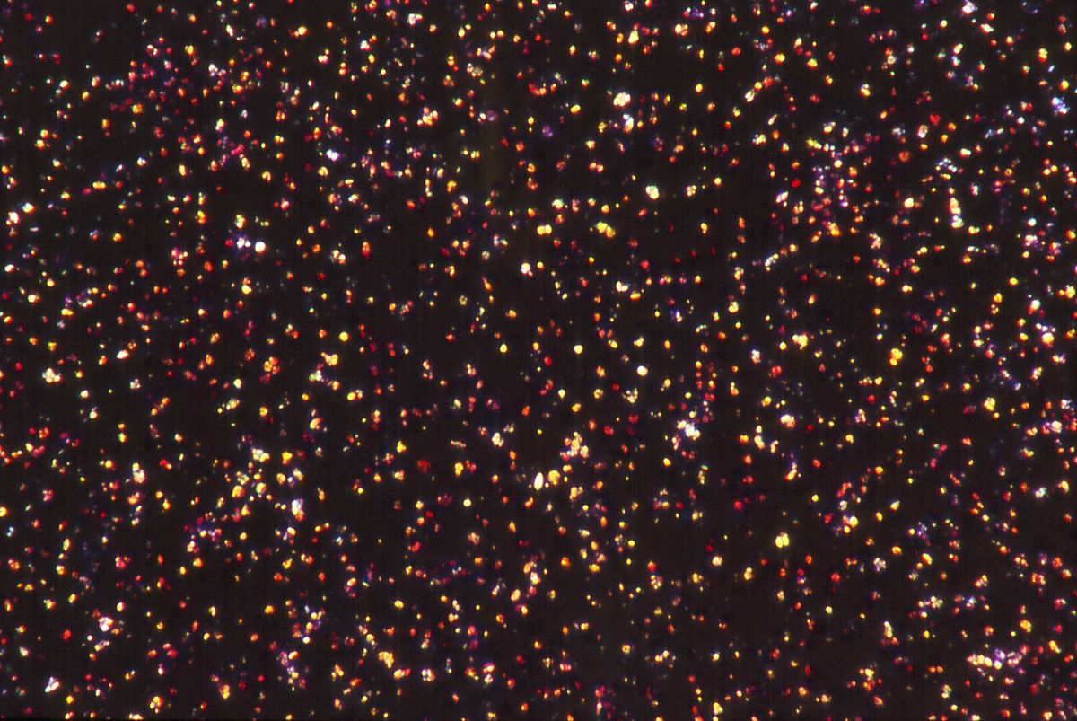 Кристали гемозоїну у поляризованому світлі. Hempelmann / Wikimedia Commons