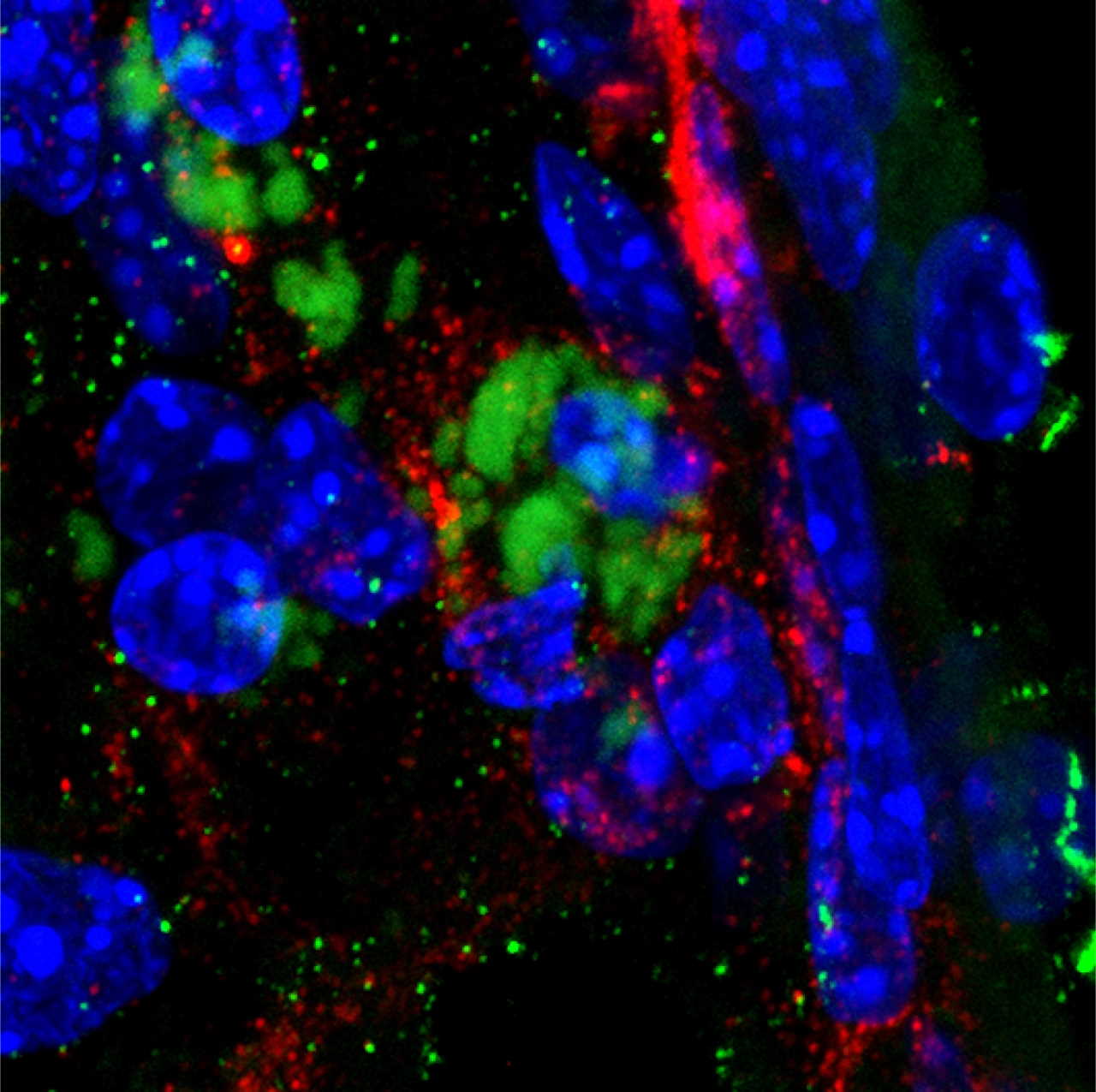 Бактерії&amp;nbsp;C. pneumoniae (зелені) в тканині нюхової цибулини, навколо яких скупчується бета-амілоїд (червоний). Синім позначено ядра мозкових клітин.&amp;nbsp;Griffith University