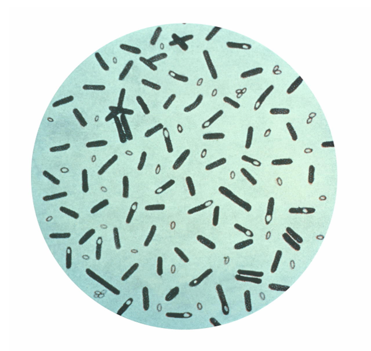 Clostridium botulinum під мікроскопом. Ці бактерії можуть спричиняти рідкісне захворювання, що вражає нервову систему — ботулізм. CDC