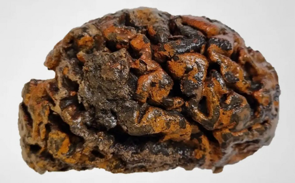 Людські мізки виявилися здатними зберігатися протягом 12 тисяч років