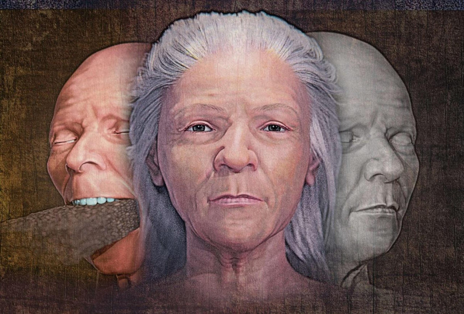 Жінці-«вампірці» з цеглиною у роті реконструювали обличчя